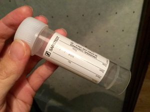 A empty small plastic medical tube you use when you need to get a doctor in England